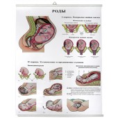 Роды (85х60 см)