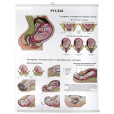 Роды (85х60 см)