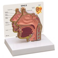 Околоносовые пазухи в поперечном сечении