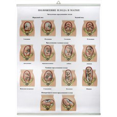 Положение плода в матке (85х60 см)